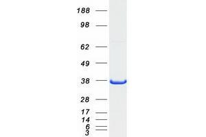 Validation with Western Blot