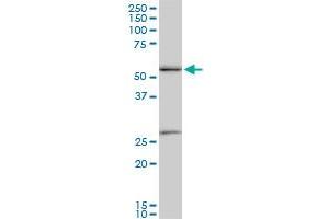 PRPF19 monoclonal antibody (M07), clone 2E5.