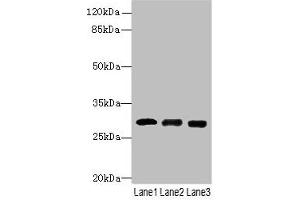 Western blot All lanes: CELA3A antibody at 14 μg/mL Lane 1: Mouse heart tissue Lane 2: Mouse skeletal muscle tissue Lane 3: Jurkat whole cell lysate Secondary Goat polyclonal to rabbit IgG at 1/10000 dilution Predicted band size: 30 kDa Observed band size: 30 kDa (Elastase 3A anticorps  (AA 29-270))
