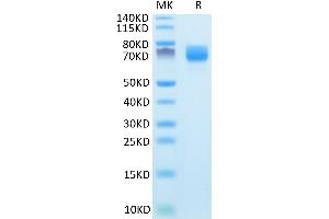 ARTN Protein (AA 112-224) (Fc Tag)