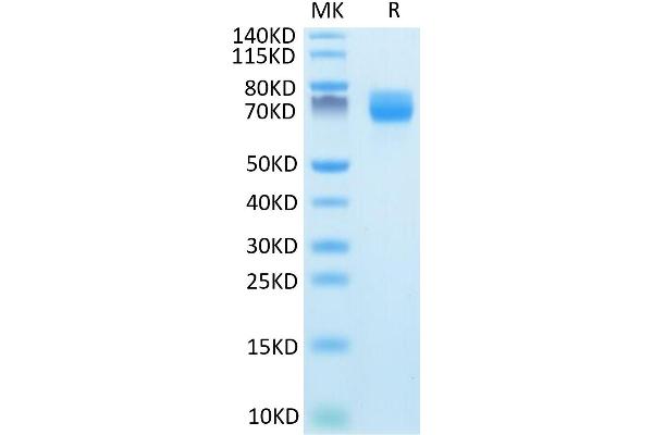 ARTN Protein (AA 112-224) (Fc Tag)