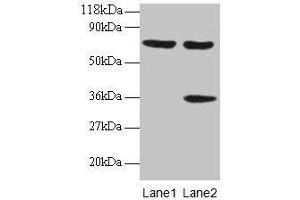 Western blot All lanes: SYNCRIP antibody at 2 μg/mL Lane 1: EC109 whole cell lysate Lane 2: 293T whole cell lysate Secondary Goat polyclonal to rabbit IgG at 1/15000 dilution Predicted band size: 70, 66, 63, 59, 47 kDa Observed band size: 70, 36 kDa