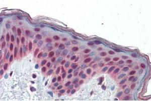 Human Skin (formalin-fixed, paraffin-embedded) stained with TCF7L1 antibody ABIN462163 followed by biotinylated goat anti-rabbit IgG secondary antibody ABIN481713, alkaline phosphatase-streptavidin and chromogen.