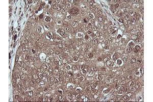 Image no. 3 for anti-Mitogen-Activated Protein Kinase Kinase 1 (MAP2K1) antibody (ABIN1499374)