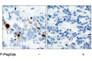 Image no. 1 for anti-Histone H3.1 (HIST1H3B) (pSer10) antibody (ABIN196922) (Histone H3.1 anticorps  (pSer10))