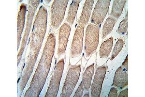 IHC analysis of FFPE human skeletal muscle stained with PDK4 antibody