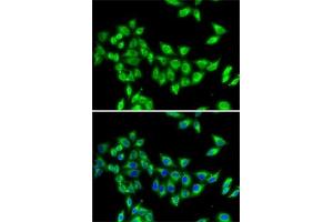 Immunofluorescence analysis of MCF7 cells using KIF3A antibody (ABIN6128170, ABIN6142871, ABIN6142872 and ABIN6222335). (KIF3A anticorps  (AA 430-699))