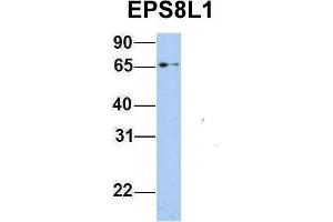Host:  Rabbit  Target Name:  EPS8L1  Sample Type:  293T  Antibody Dilution:  1. (EPS8-Like 1 anticorps  (Middle Region))
