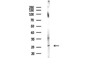 Western blot analysis of lysates from Mouse brain, using EBAG9 Antibody at 1/1000 dilution.