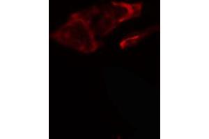 ABIN6266880 staining HeLa cells by IF/ICC. (COL5A1 anticorps  (N-Term))