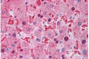 Human Liver (formalin-fixed, paraffin-embedded) stained with XIAP antibody ABIN214586 at 2 ug/ml followed by biotinylated goat anti-rabbit IgG secondary antibody ABIN481713, alkaline phosphatase-streptavidin and chromogen. (XIAP anticorps  (C-Term))