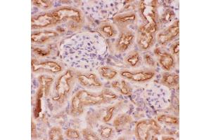 Anti-P Glycoprotein Picoband antibody, .