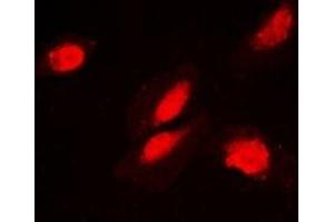 Immunofluorescent analysis of FKBP3 staining in MCF7 cells. (FKBP3 anticorps)