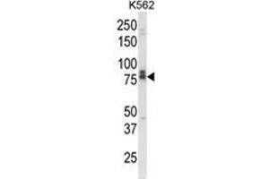 Western blot analysis of IL18RAP Antibody (N-term) in K562 cell line lysates (35ug/lane). (IL18RAP anticorps  (N-Term))
