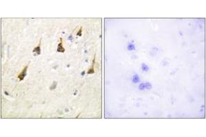 Immunohistochemistry analysis of paraffin-embedded human brain tissue, using SENP7 Antibody. (SENP7 anticorps  (AA 991-1040))
