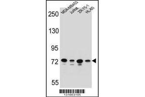 Western blot analysis in MDA-MB453,Jurkat,ZR-75-1,HL-60 cell line lysates (35ug/lane). (PCDHB15 anticorps  (N-Term))