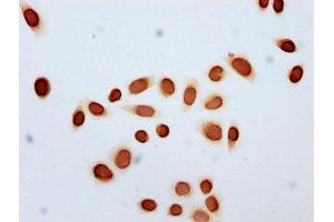 Immunocytochemistry analysis of ABIN7139149 diluted at 1:20 and staining in Hela cells (treated with 30mM sodium butyrate for 4h) performed on a Leica BondTM system.