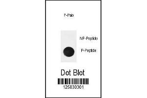 Dot blot analysis of phospho-IkBa antibody.