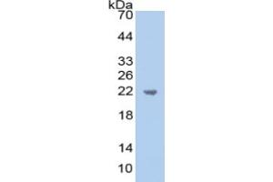 WB of Protein Standard: different control antibodies against Highly purified E. (AMBP Kit ELISA)