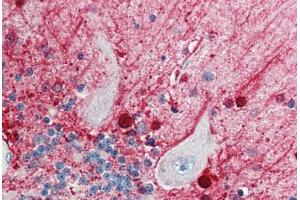 Human Brain, Cerebellum (formalin-fixed, paraffin-embedded) stained with CASP5 antibody ABIN214433 at 5 ug/ml followed by biotinylated goat anti-rabbit IgG secondary antibody ABIN481713, alkaline phosphatase-streptavidin and chromogen. (CASP5 anticorps)