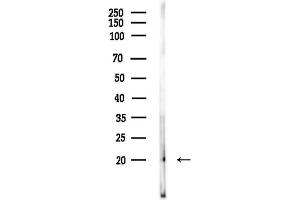 Western blot analysis of lysates from LoVo cells(heat-shock,45 min treatment), using RHEB Antibody at 1/1000 dilution.