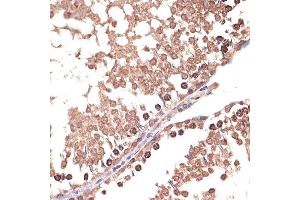 Immunohistochemistry of paraffin-embedded rat testis using B Rabbit mAb (ABIN7265826) at dilution of 1:100 (40x lens).