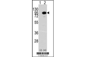 Western blot analysis of ACO2 using rabbit polyclonal ACO2 Antibody. (ACO2 anticorps  (AA 294-325))