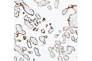 IHC analysis of MTR using anti-MTR antibody (ABIN7602599).