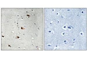 Immunohistochemical analysis of paraffin-embedded human brain tissue using E2A (Phospho-Thr355) antibody (left)or the same antibody preincubated with blocking peptide (right). (TCF3 anticorps  (pThr355))