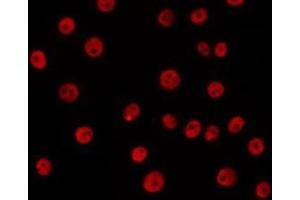 ABIN6266647 staining 293 by IF/ICC.