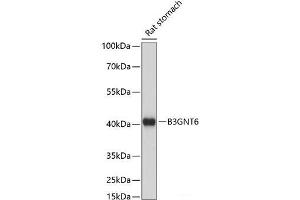 Western blot analysis of extracts of Rat stomach using B3GNT6 Polyclonal Antibody at dilution of 1:1000. (B3GNT6 anticorps)