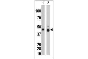 The anti-CKB Pab (ABIN391073 and ABIN2841220) is used in Western blot to detect CKB in mouse colon tissue lysate (Lane 1) and Y79 cell lysate (Lane 2). (CKB anticorps  (N-Term))