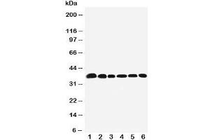 Western blot testing of Nucleophosmin antibody and Lane 1:  rat testis;  2: (r) brain;  3: human HeLa;  4: (h) U87;  5: (h)A549;  6: (h) SMMC-7721 cell lysate. (NPM1 anticorps  (N-Term))