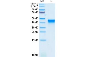 Mouse CD38 on Tris-Bis PAGE under reduced condition. (CD38 Protein (AA 45-304) (His tag))