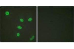 Immunofluorescence analysis of HeLa cells, using Histone H3 (Acetyl-Lys27) Antibody. (Histone 3 anticorps  (H3K27ac))