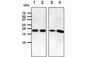 The lysates (40ug) were resolved by SDS-PAGE, transferred to PVDF membrane and probed with anti-human ARF1 antibody (1:1000). (ARF1 anticorps)
