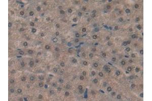 Detection of HPRT1 in Human Liver Tissue using Polyclonal Antibody to Hypoxanthine Phosphoribosyltransferase 1 (HPRT1)