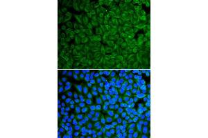 Immunofluorescence analysis of A549 cell using GAD2 antibody. (GAD65 anticorps  (AA 401-585))