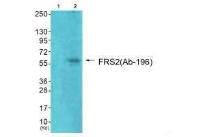 Western blot analysis of extracts from 293 cells (Lane 2), using FRS2 (Ab-196) antiobdy. (FRS2 anticorps  (Tyr196))