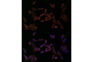 anti-Midkine (Neurite Growth-Promoting Factor 2) (MDK) (AA 21-143) antibody