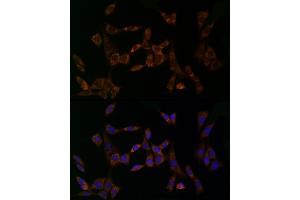 Immunofluorescence analysis of NIH/3T3 cells using MDK Rabbit pAb (ABIN3020790, ABIN3020791, ABIN3020792 and ABIN6213725) at dilution of 1:25 (40x lens). (Midkine anticorps  (AA 21-143))