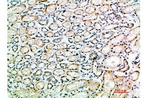 Immunohistochemical analysis of paraffin-embedded human-kidney, antibody was diluted at 1:200 (Angiotensin I Converting Enzyme 1 anticorps  (AA 41-90))