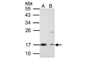WB Image Survivin antibody detects Survivin protein by Western blot analysis. (Survivin anticorps  (C-Term))