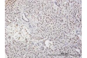 Image no. 3 for anti-Myeloid Leukemia Factor 2 (MLF2) (AA 1-249) antibody (ABIN599027) (MLF2 anticorps  (AA 1-249))