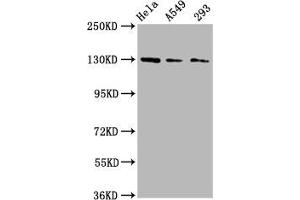 Western Blot Positive WB detected in: Hela whole cell lysate, A549 whole cell lysate, 293 whole cell lysate All lanes: SEMA6D antibody at 3 μg/mL Secondary Goat polyclonal to rabbit IgG at 1/50000 dilution Predicted band size: 120, 114, 112, 116, 118, 55, 68 kDa Observed band size: 130 kDa (SEMA6D anticorps  (AA 913-1068))