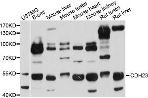 Western blot analysis of extracts of various cell lines, using CDH23 antibody (ABIN1871709) at 1:1000 dilution. (CDH23 anticorps)