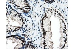 Immunohistochemical staining of paraffin-embedded colon tissue using anti-PSMC3mouse monoclonal antibody.