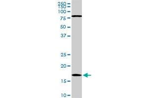 Western Blotting (WB) image for anti-Cofilin 1 (CFL1) (AA 1-167) antibody (ABIN598606) (Cofilin anticorps  (AA 1-167))