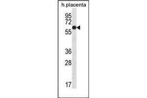 Western blot analysis of LCCI1 Antibody (Center) in human placenta tissue lysates (35ug/lane).