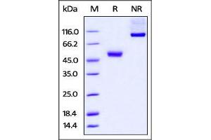 Human CTLA-4, mouse IgG2a Fc Tag, low endotoxin on SDS-PAGE under reducing (R) and no-reducing (NR) conditions.